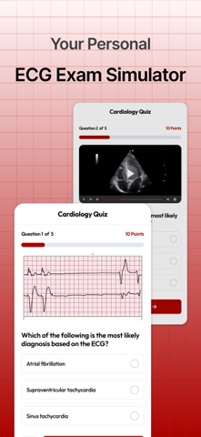 Cardiogram Cases: EKG Practice Screenshot 4 of 6