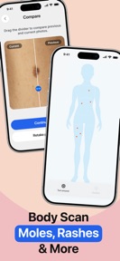 Mole Tracker: Skin Care App screenshot