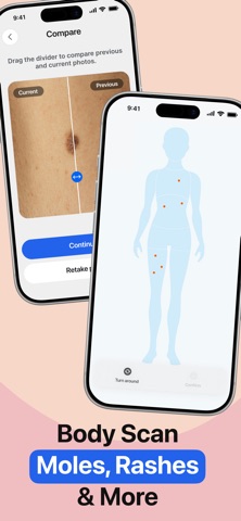 Mole Tracker: Skin Care App iPhone screenshot
