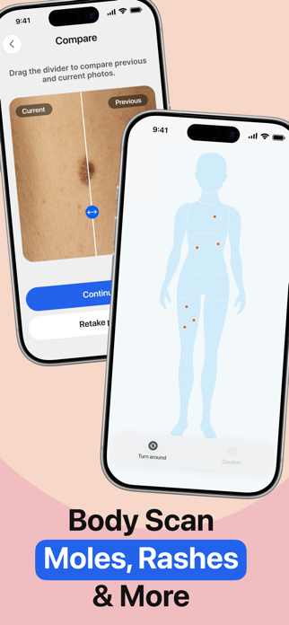 Mole Tracker - Smart Scan & Real-Time Detection on iPhone