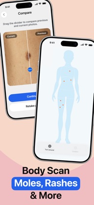 Mole Tracker: Skin Care App screenshot 2