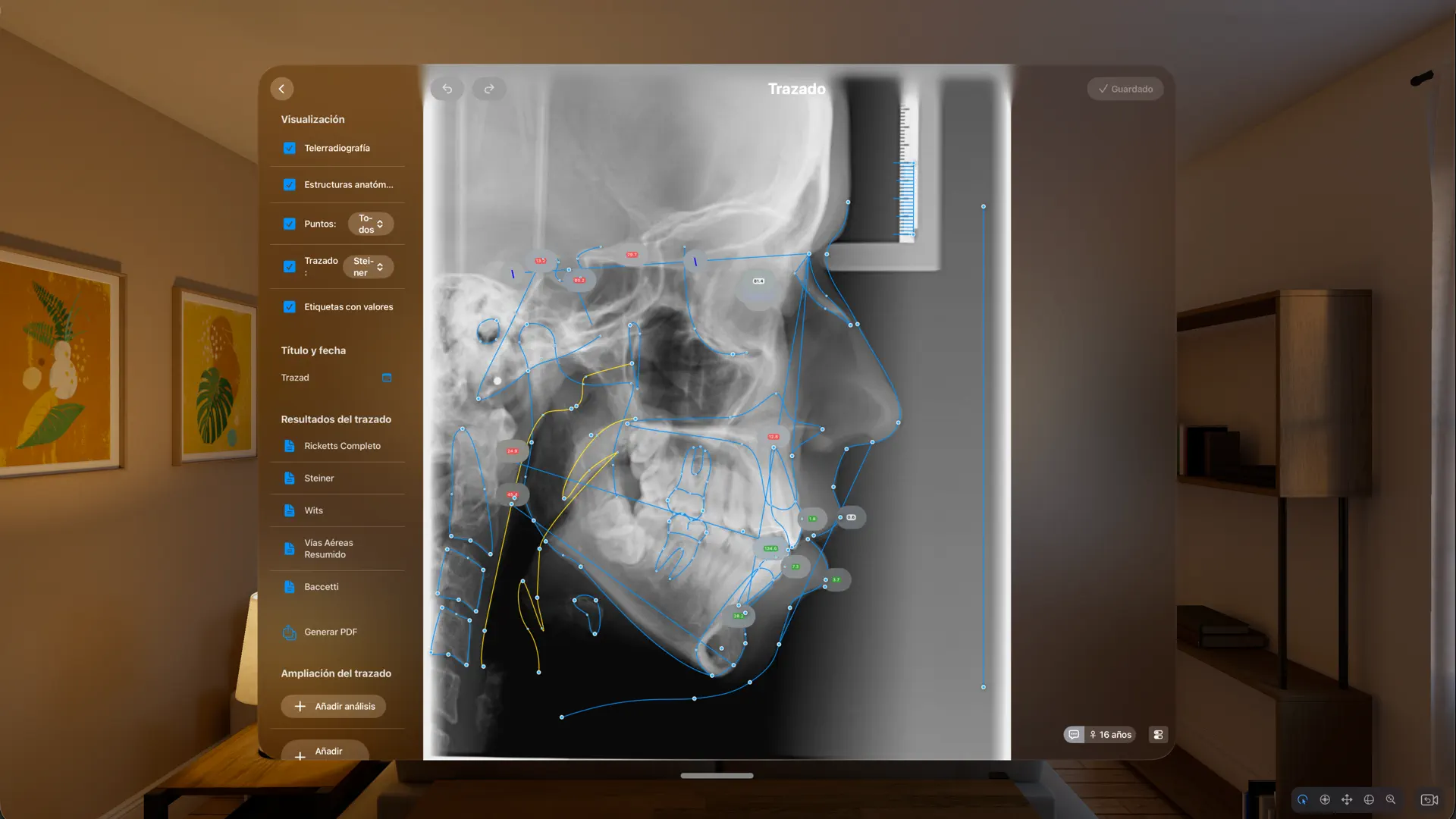 OrthoKit: Orthodontic App screenshot 4