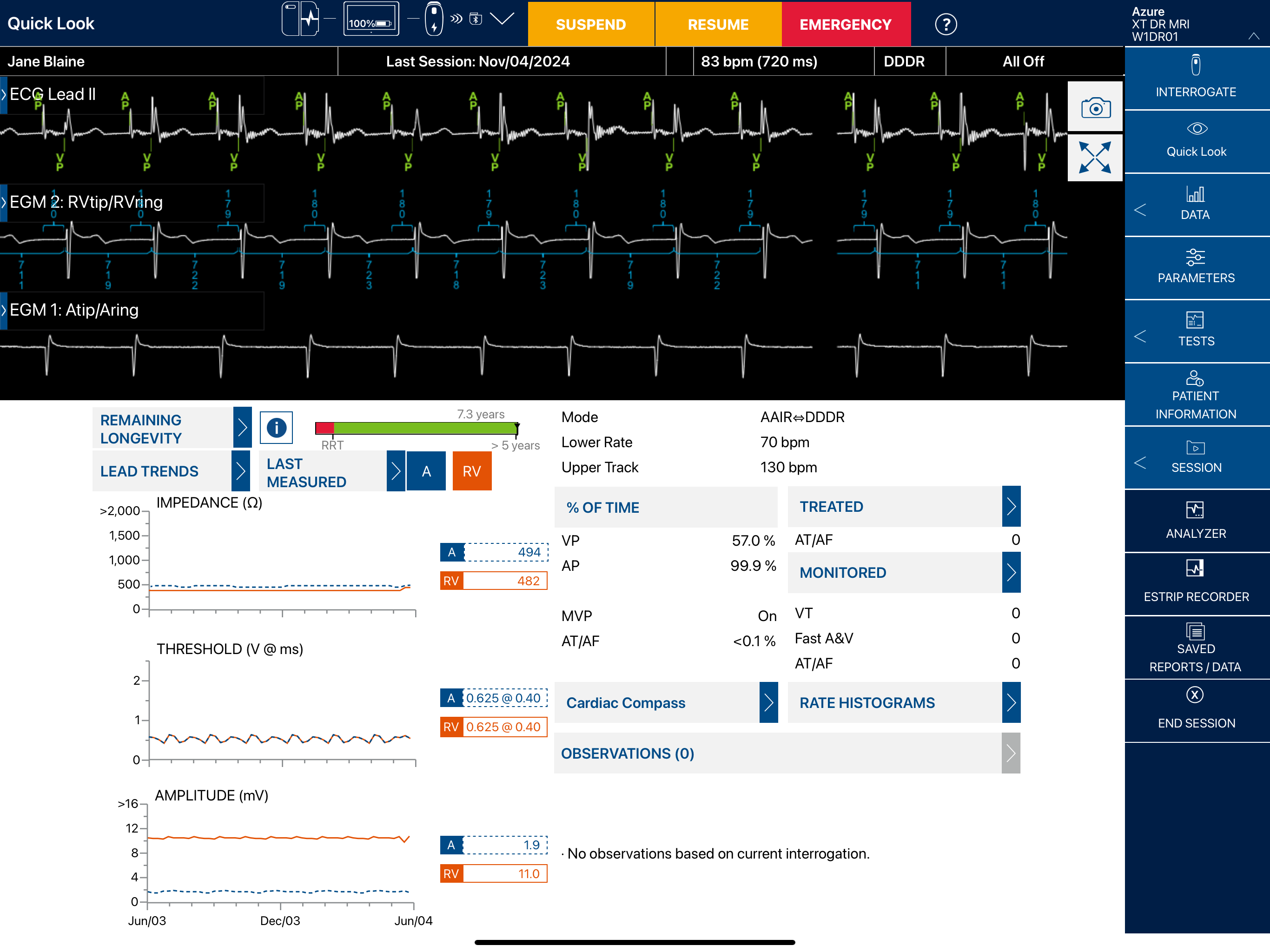 CareLink SmartSync™ MEX screenshot 5
