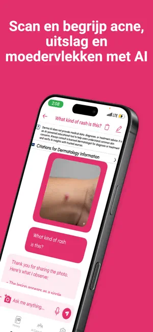 Derma AI: AI voor dermatologie iPhone screenshot 3