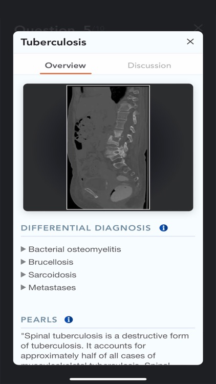 CTisus L-Spine Pathology screenshot-6