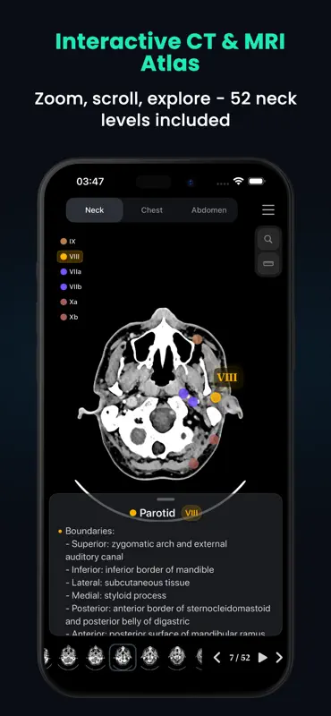 Lymph Atlas screenshot 2 of 5