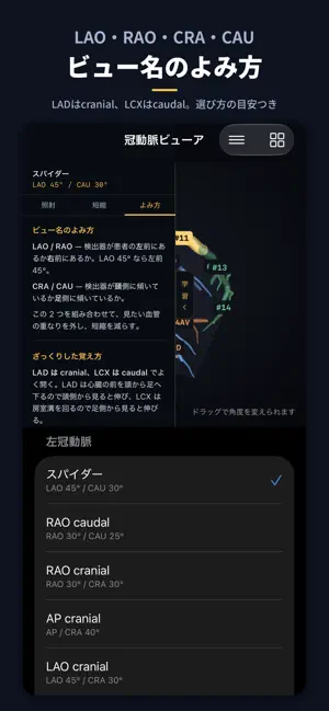 CAGView 冠動脈ビューア screenshot 2