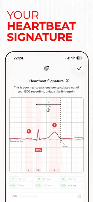 ECG+ | Analisi ECG smartwatch iPhone screenshot 5