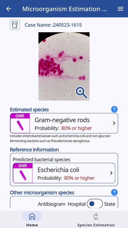 BiTTE®-iE image estimation AI