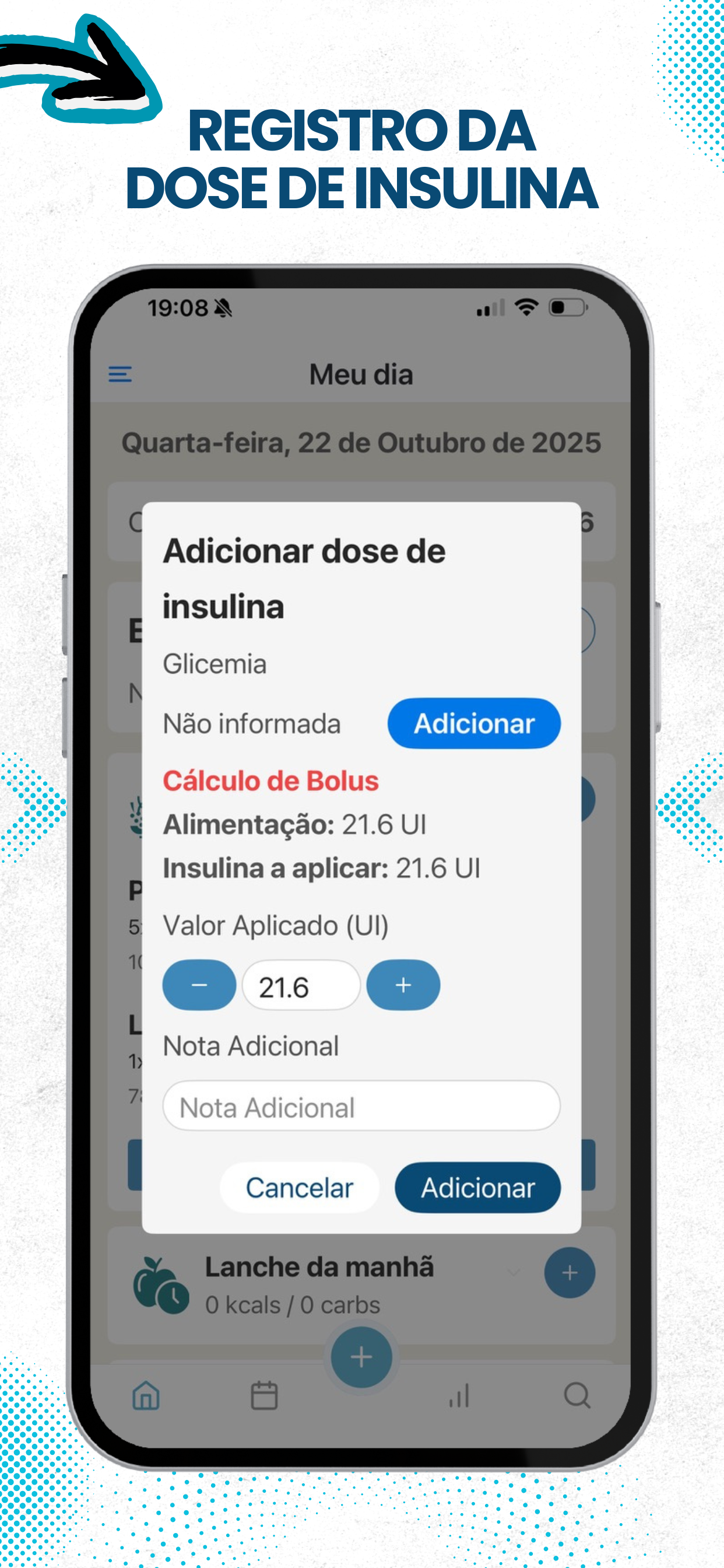 Contagem de Carboidratos - SBD