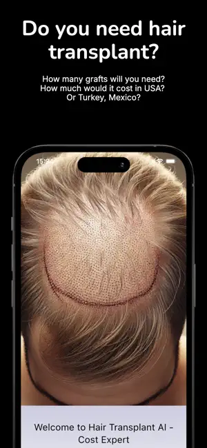 Hair Transplant AI Cost Expert screenshot 1