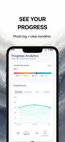 Hair Loss Tracker - BaldingAI screenshot