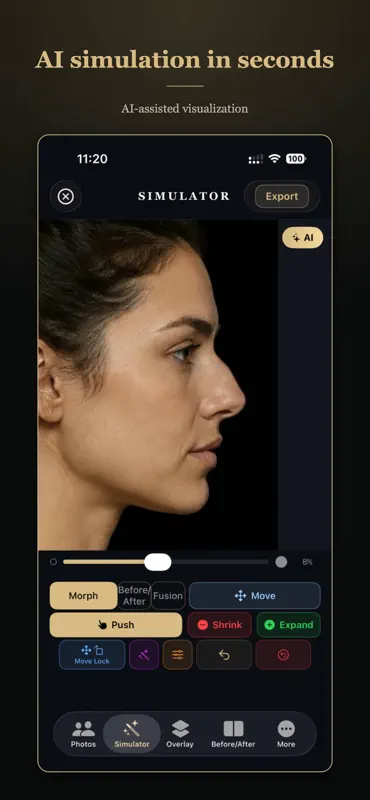 Rhinoplasty Simulator Pro screenshot 1 of 6