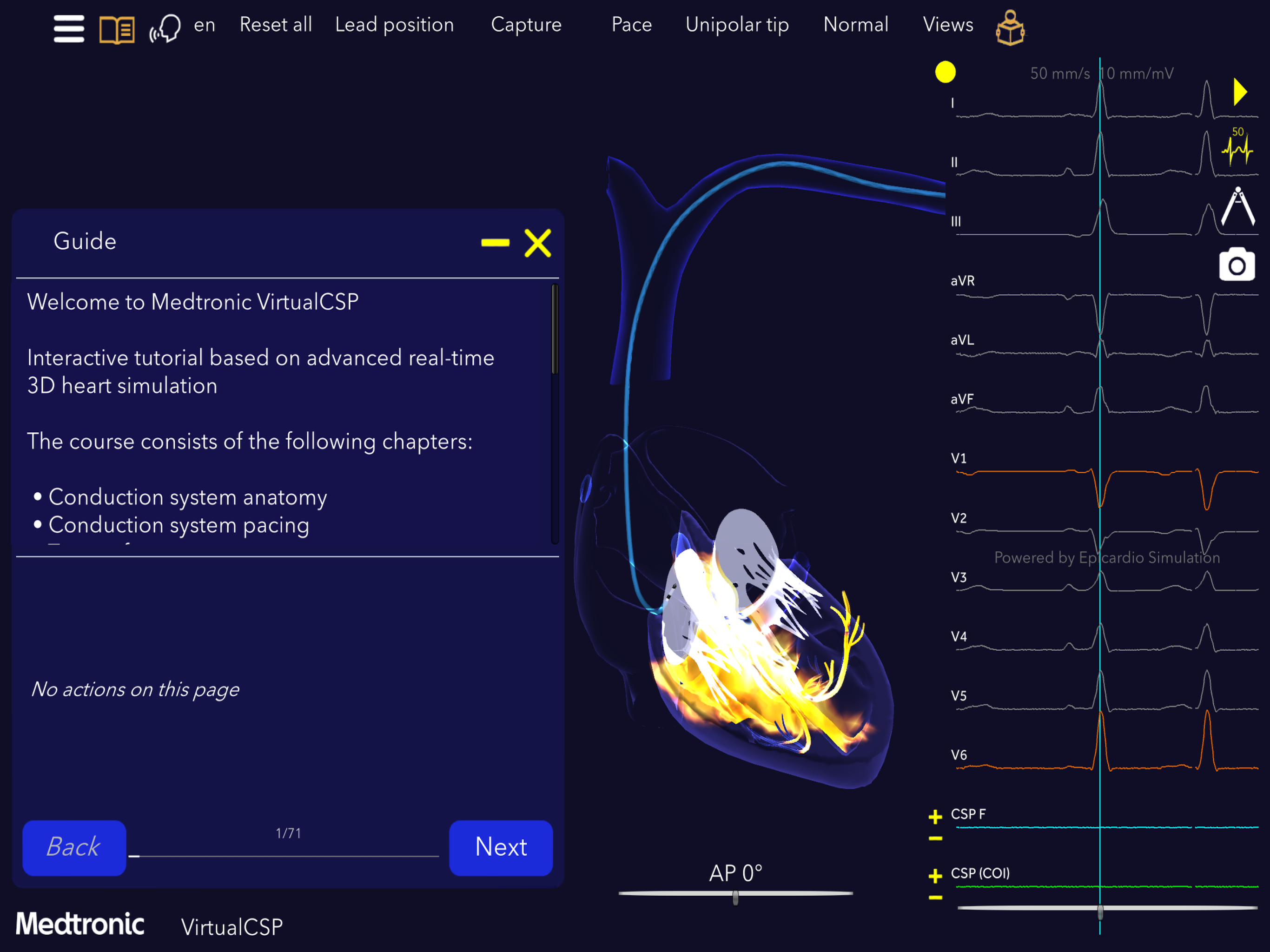 Medtronic VirtualPulse screenshot 13