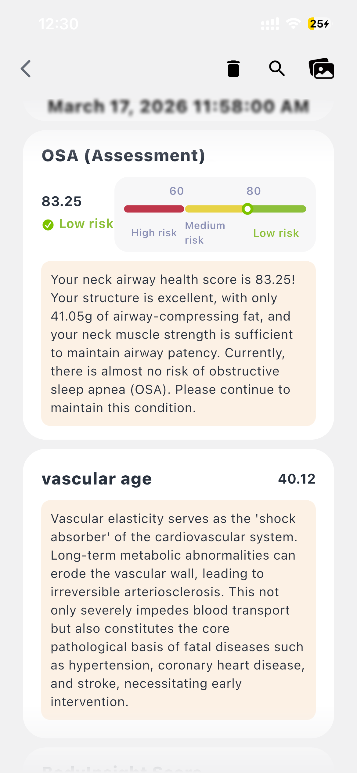 BodyInsight