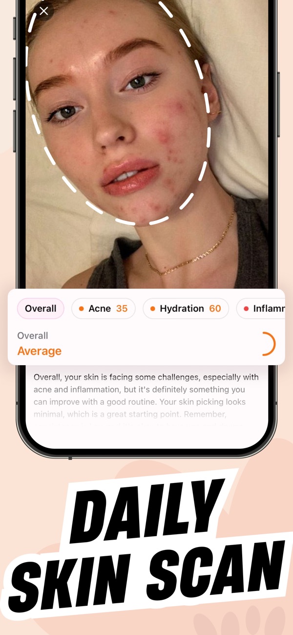 Serena: Stop Skin Picking screenshot 3