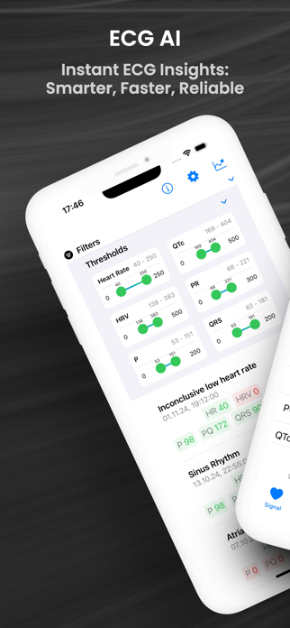 ECG AI Screenshot 1 of 10