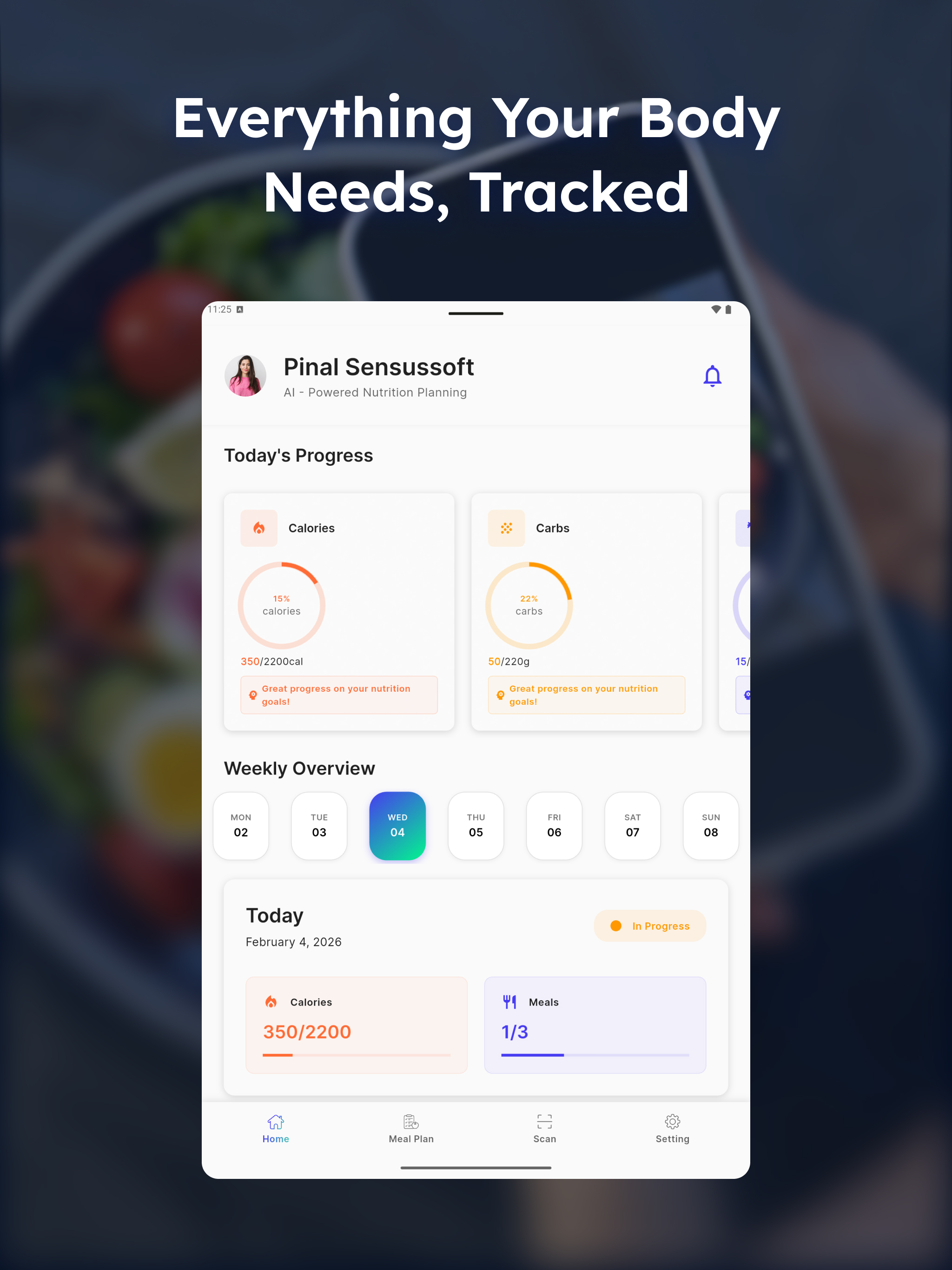 Meal Tracker - Nutriplan