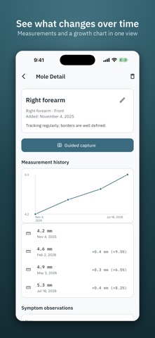 Dermory: Mole & Skin Tracker Screenshot 3 of 7