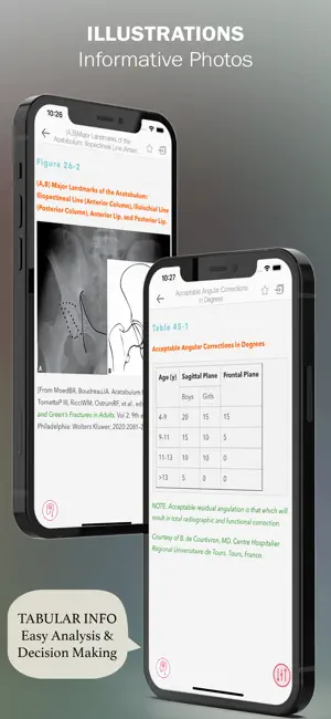 Handbook of Fractures screenshot 4
