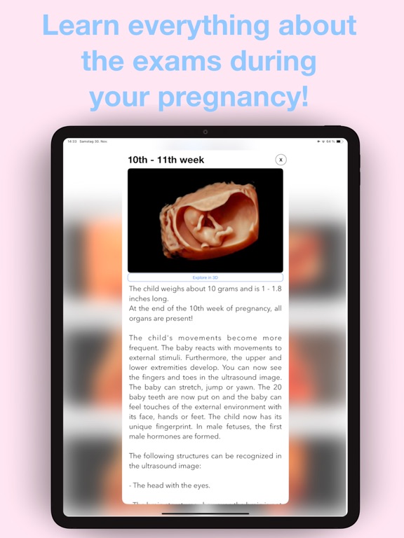 ScanBaby learn baby ultrasound iPad screenshot 7 - Medical app