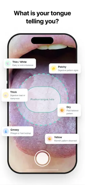 TongueRead: TCM Tongue AI Scan screenshot 1