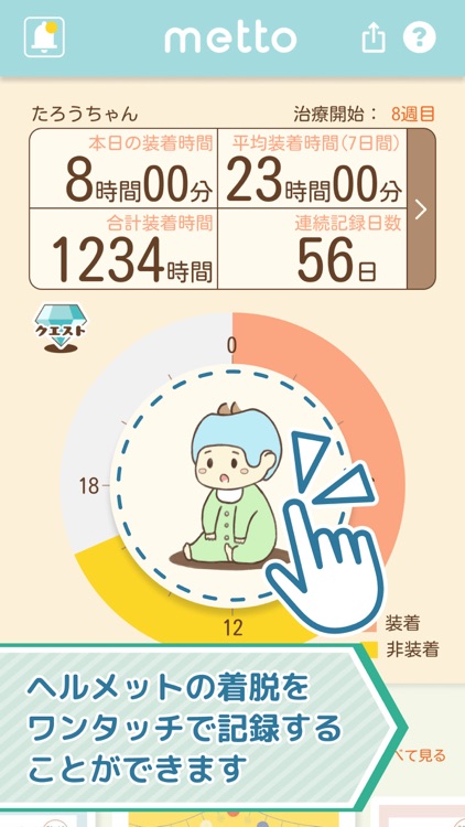 ヘルメット治療支援アプリ　metto