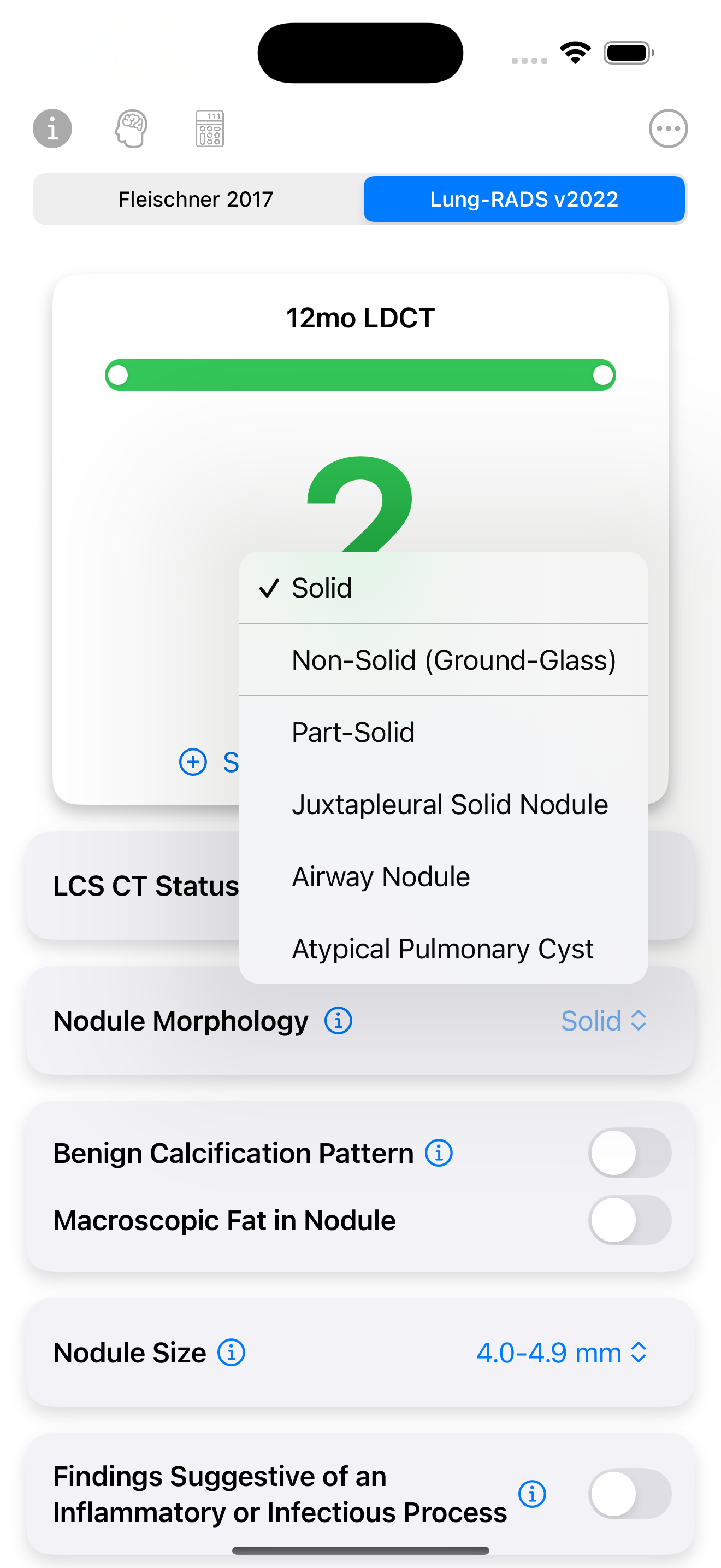 Lung Nodule Follow-up Guide