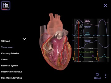 Hx Heart iPad screenshot