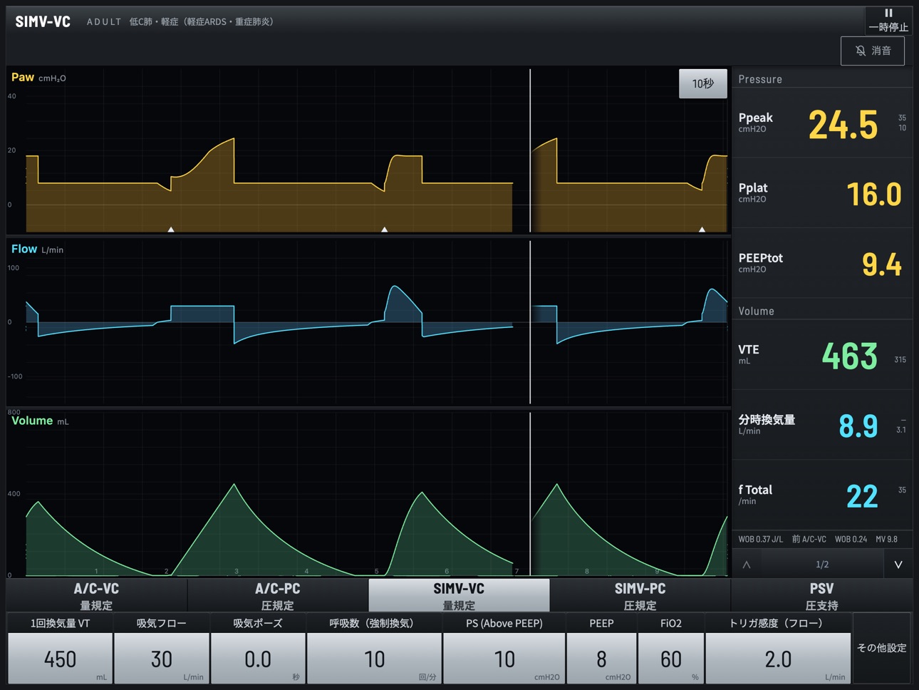 Screenshot 1 of Vent Sim - Ventilator Training