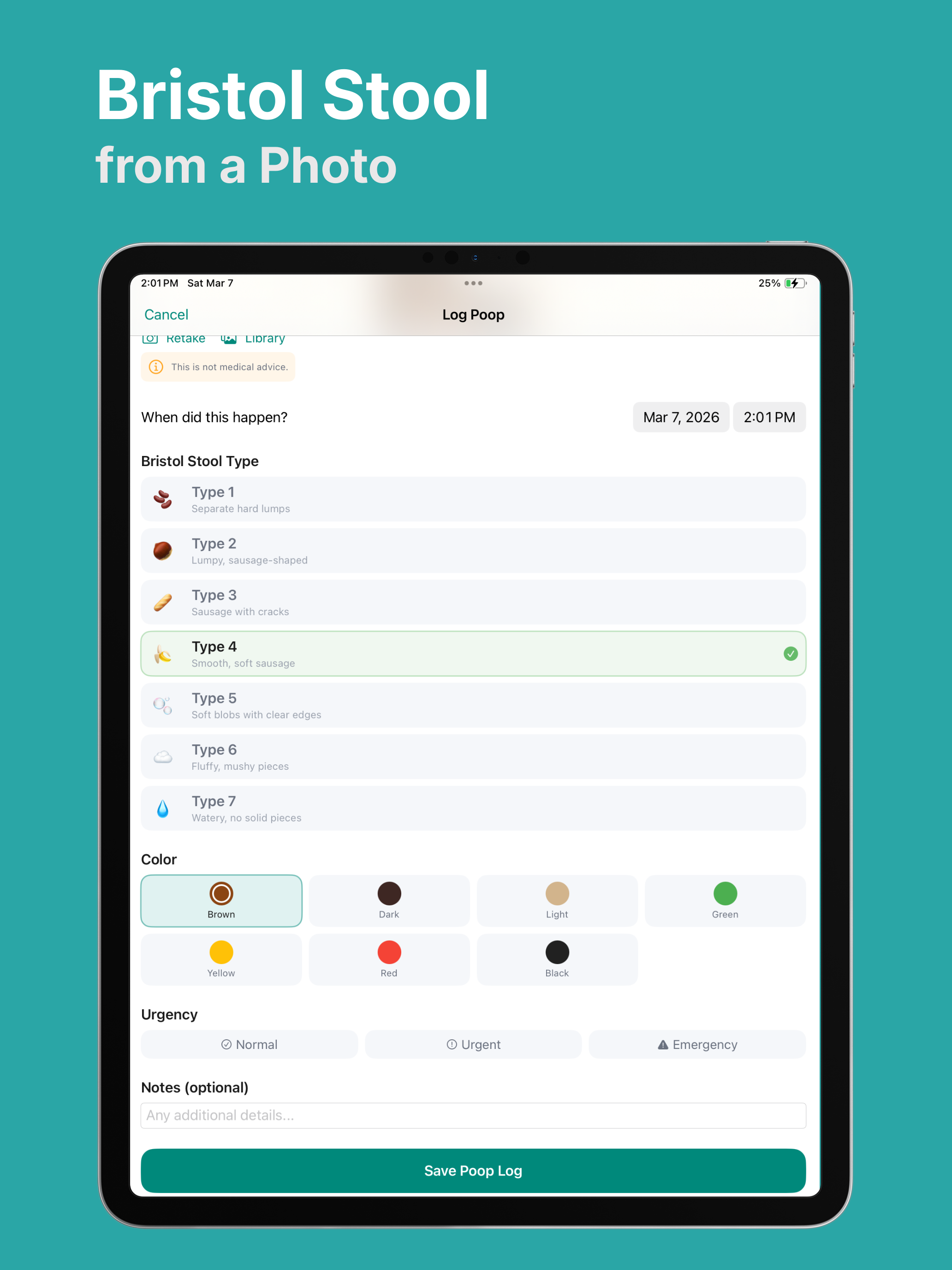 AI Gut Health and IBS Tracker