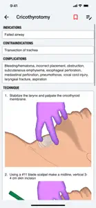 palmEM AI: EM Quick Reference screenshot #6 for iPhone