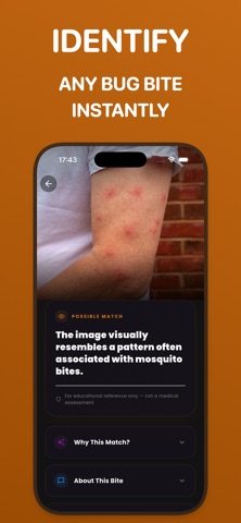 Bug Bite Scanner iPhone screenshot