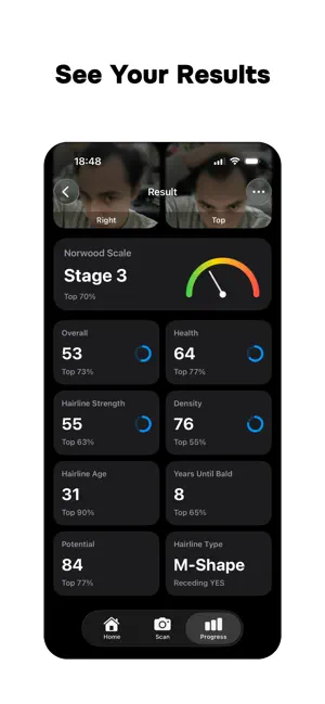 Hairline AI: Scanner & Tracker screenshot 2