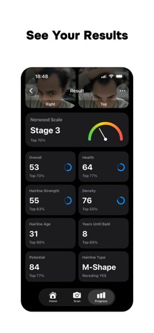 Hairline AI: Scanner & Tracker iPhone screenshot