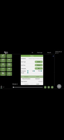 ReproScan Apexx Screenshot 4 of 8
