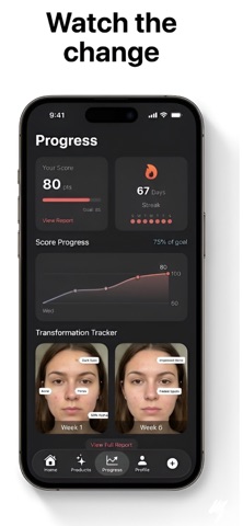 GlowUp - AI Skin Scanner screenshot