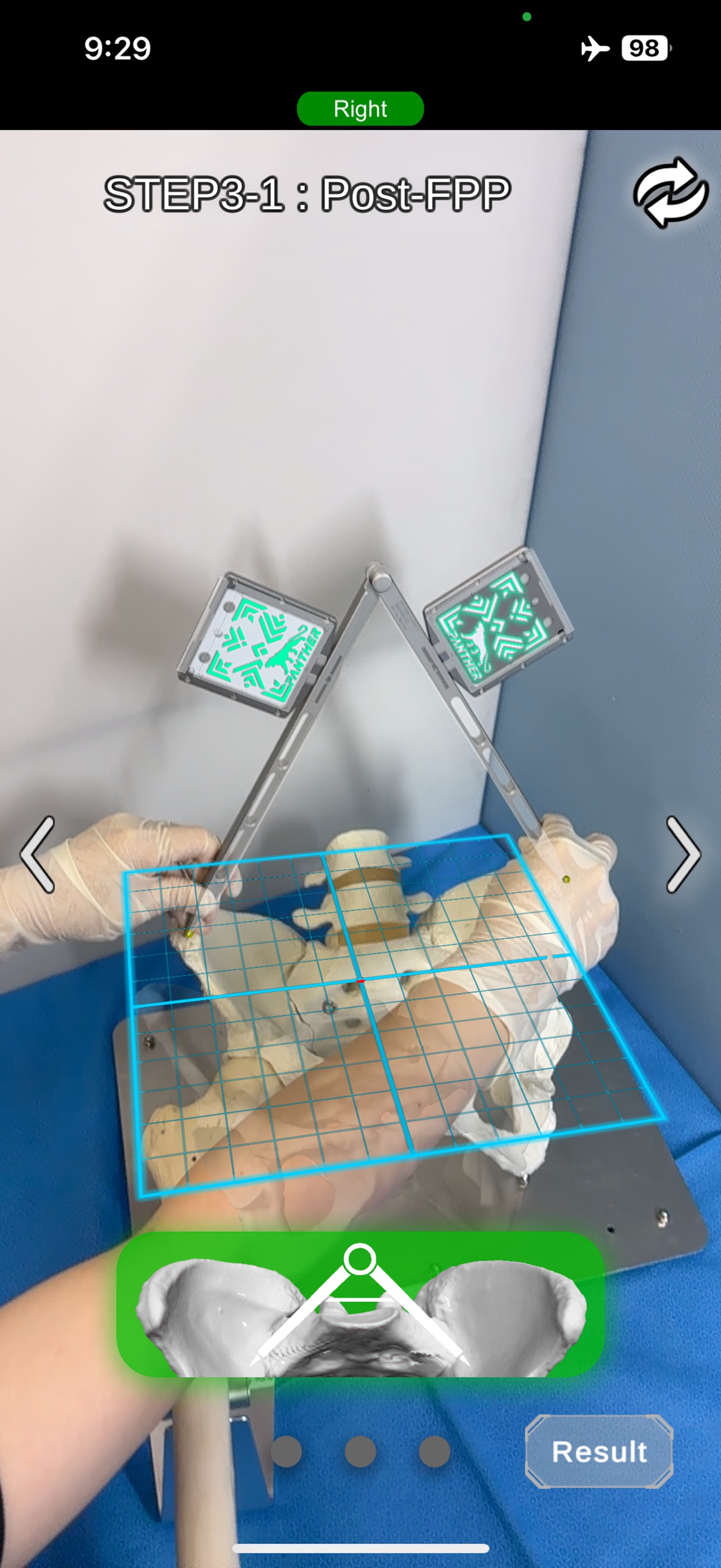 Screenshot 3 of OrthoPanther Leopard