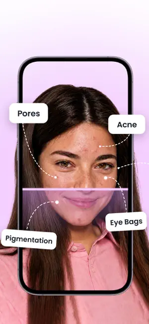 Skinzo: AI Skin Care screenshot 1