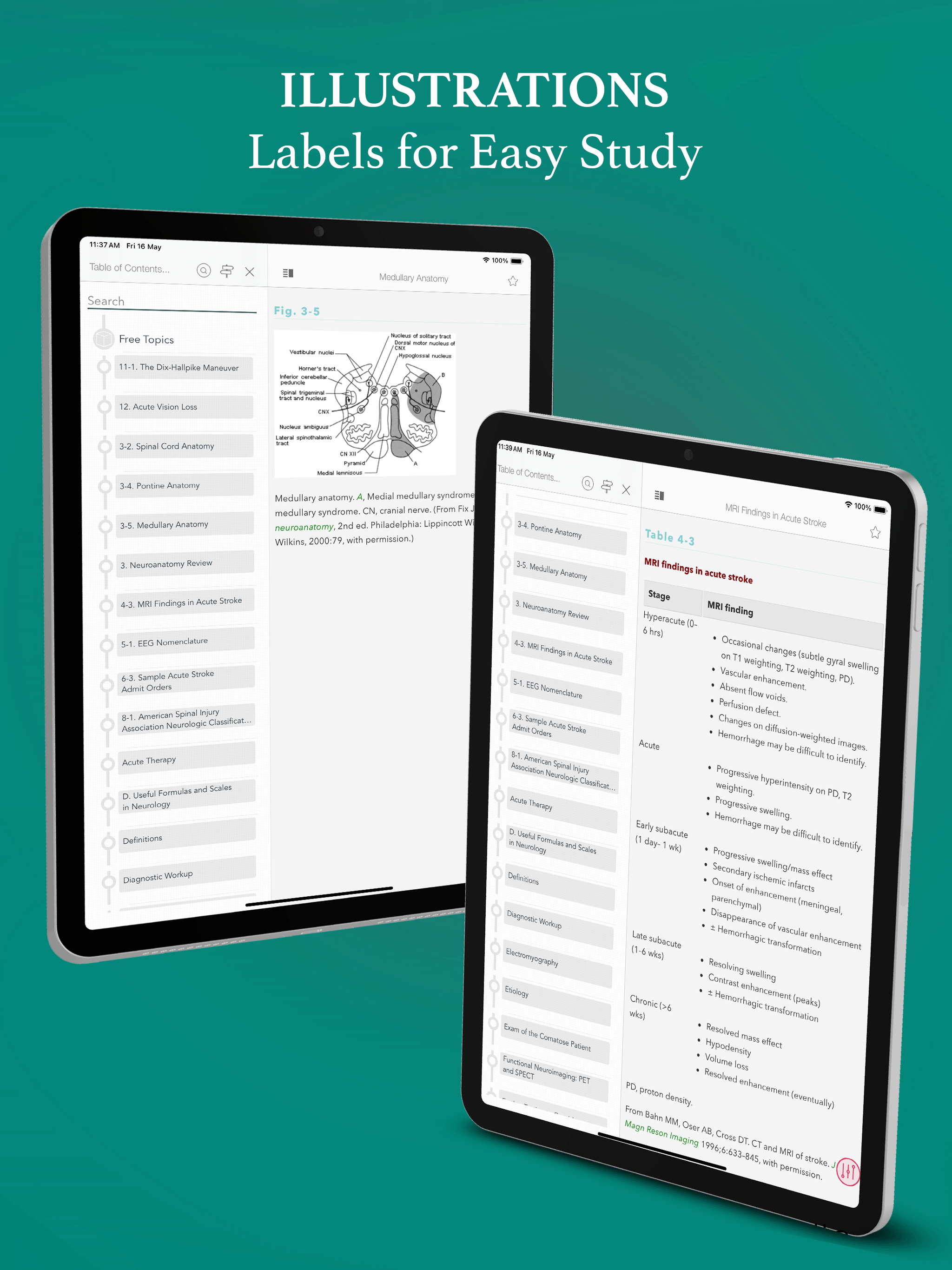 Washington Manual Neurology screenshot 14