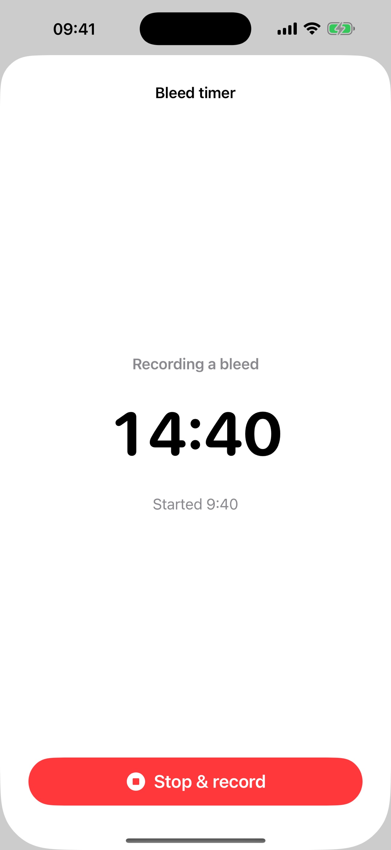 Screenshot 5 of VWD Tracker