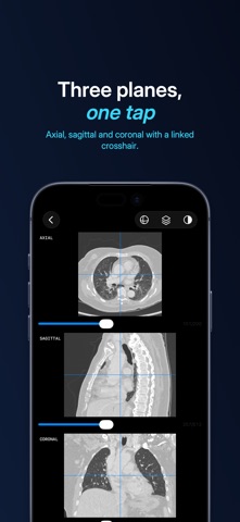 Lumen — DICOM viewer App Store preview screenshot 4