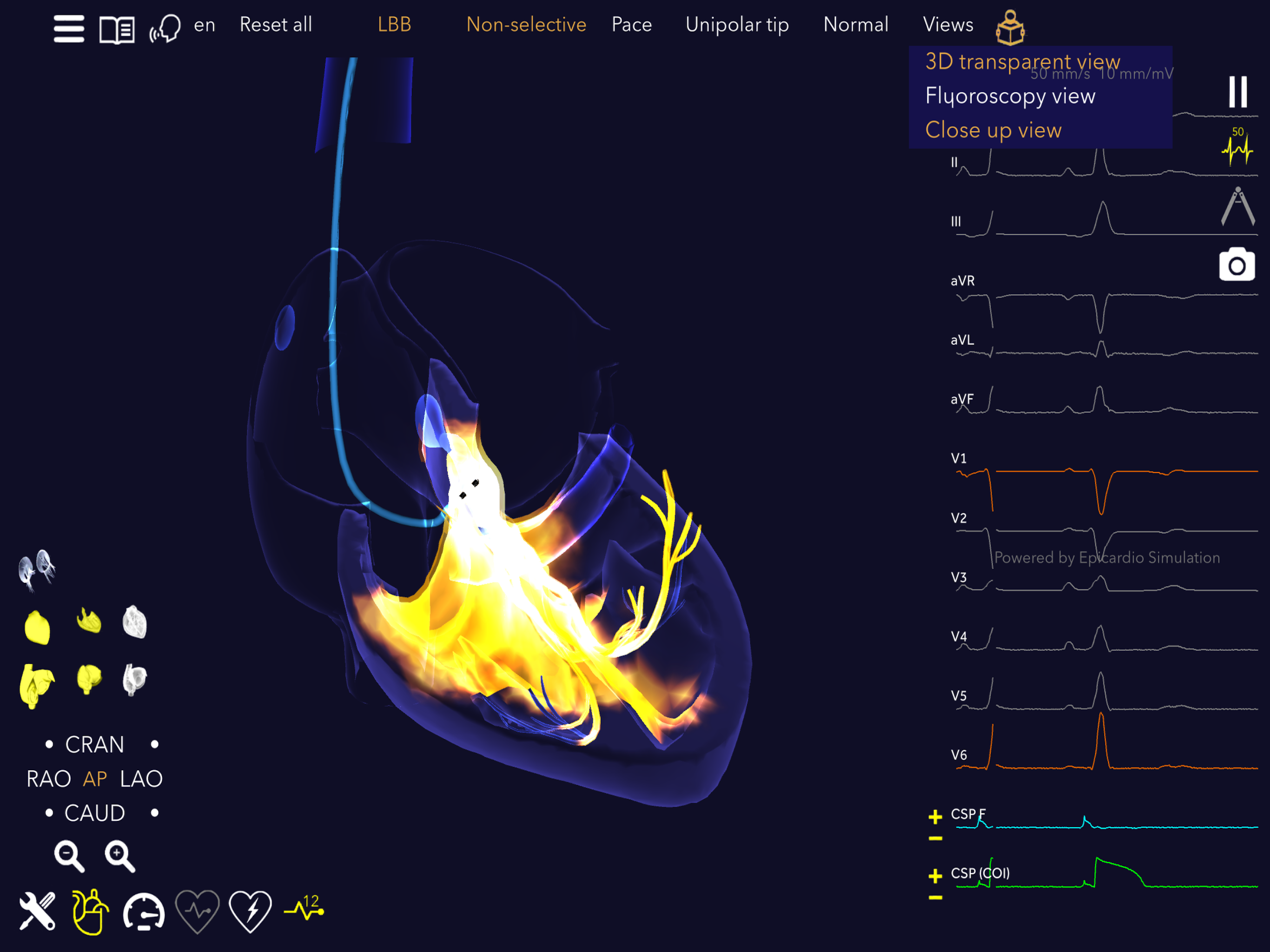 Medtronic VirtualPulse screenshot 17
