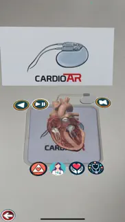cardioar problems & solutions and troubleshooting guide - 4