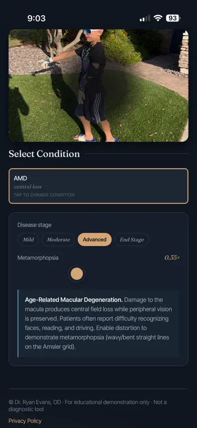 Vision Simulator by Dr. Evans screenshot 3