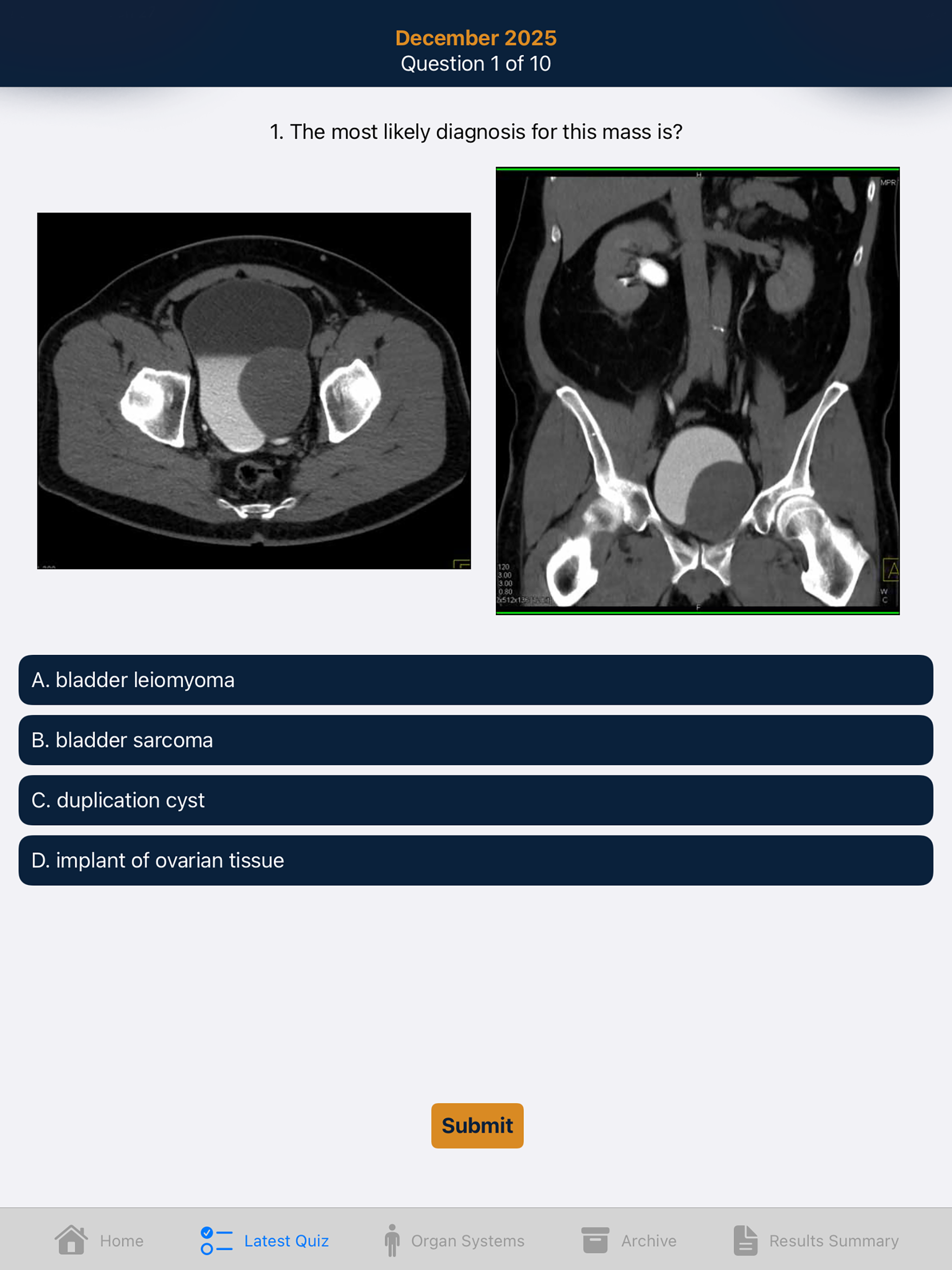 CTisus iQuiz 26