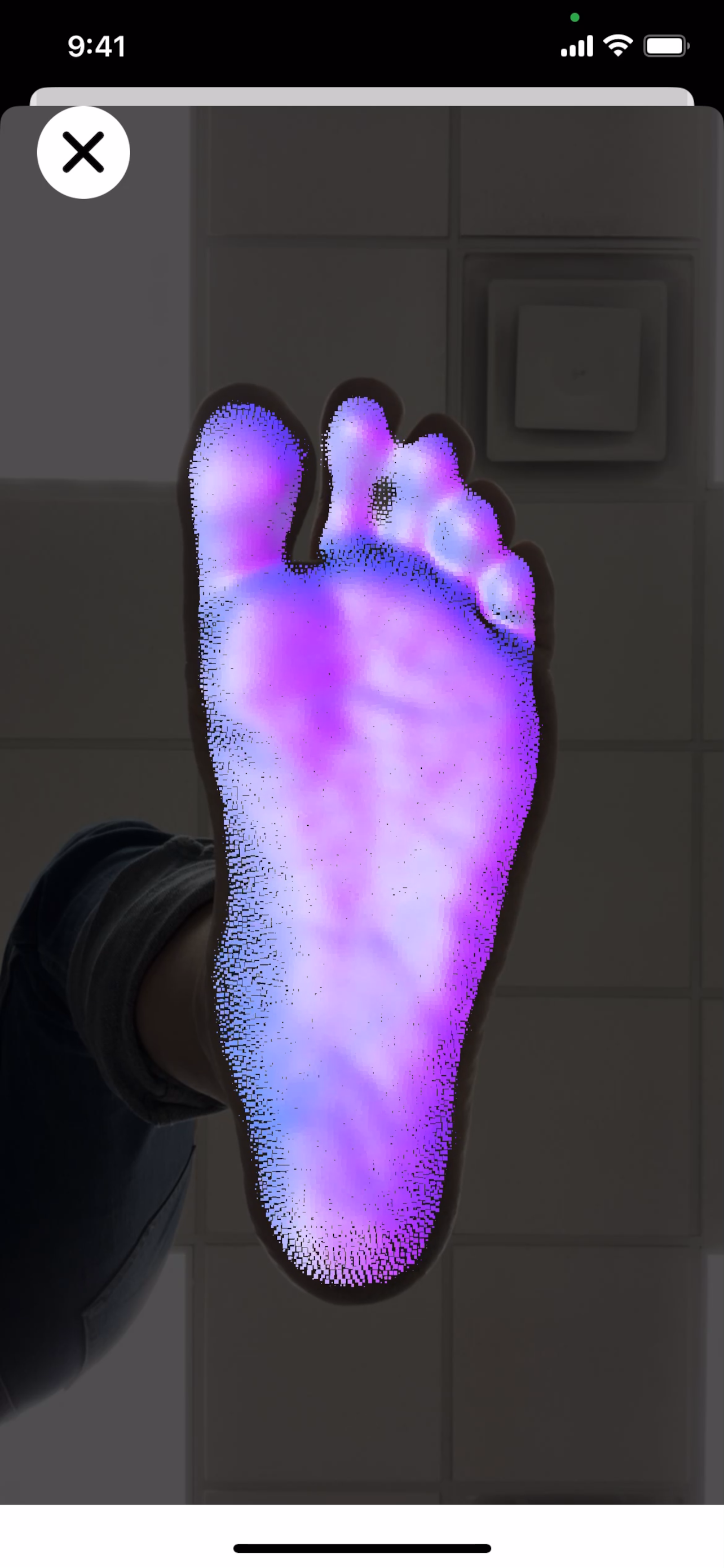 Self Scan 3D Orthotics