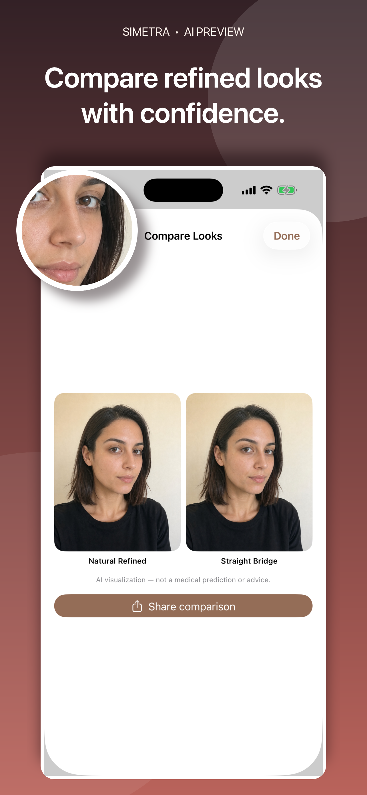 Nose Job Preview: Simetra screenshot 2