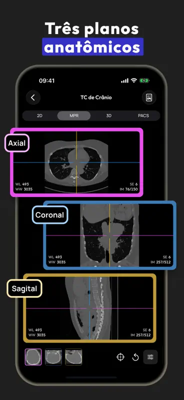 Visor DICOM - MesDICOM screenshot 2 of 8