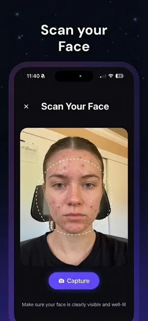 Noma - Get Rid of Acne screenshot 3